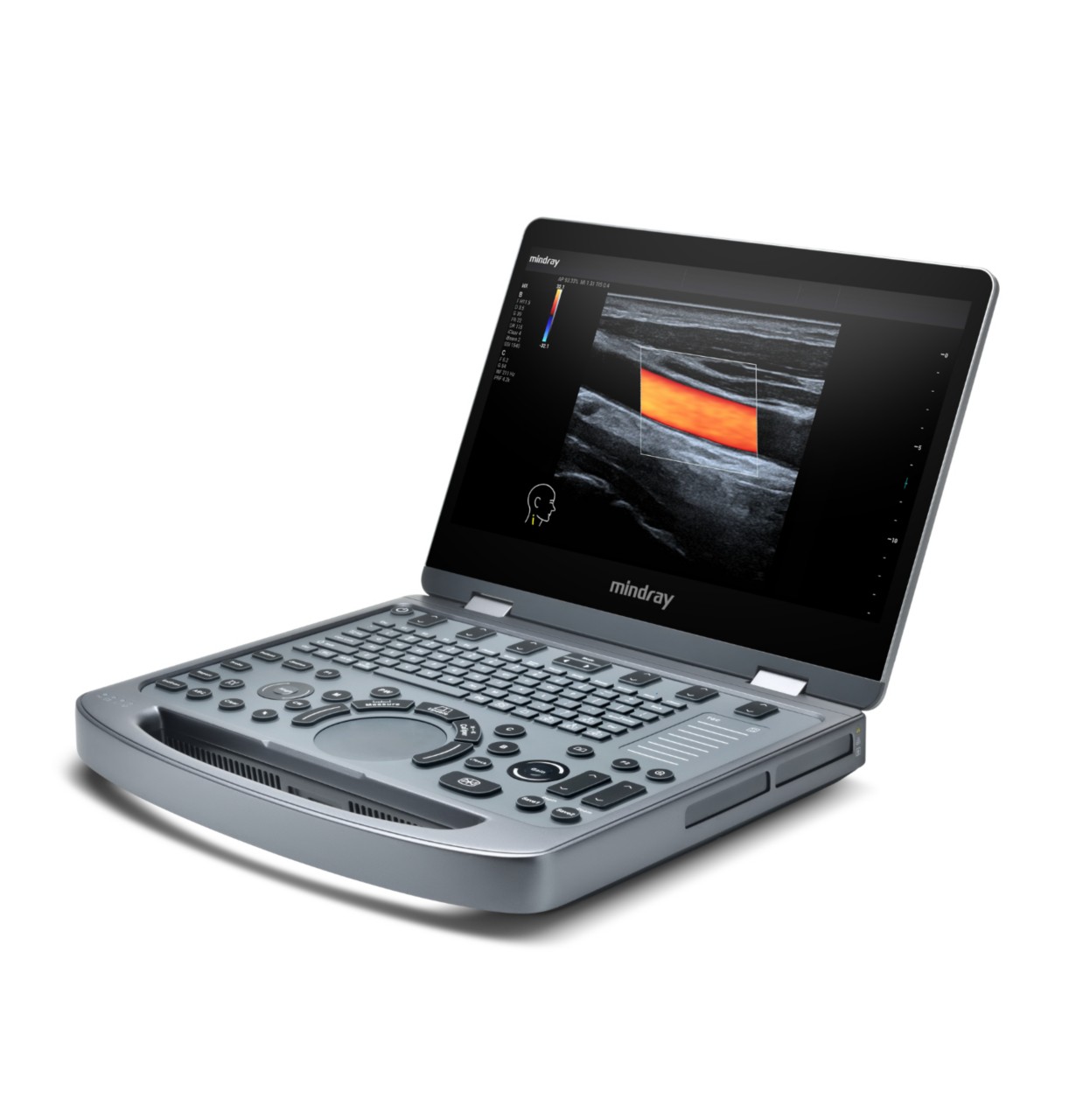 MX3