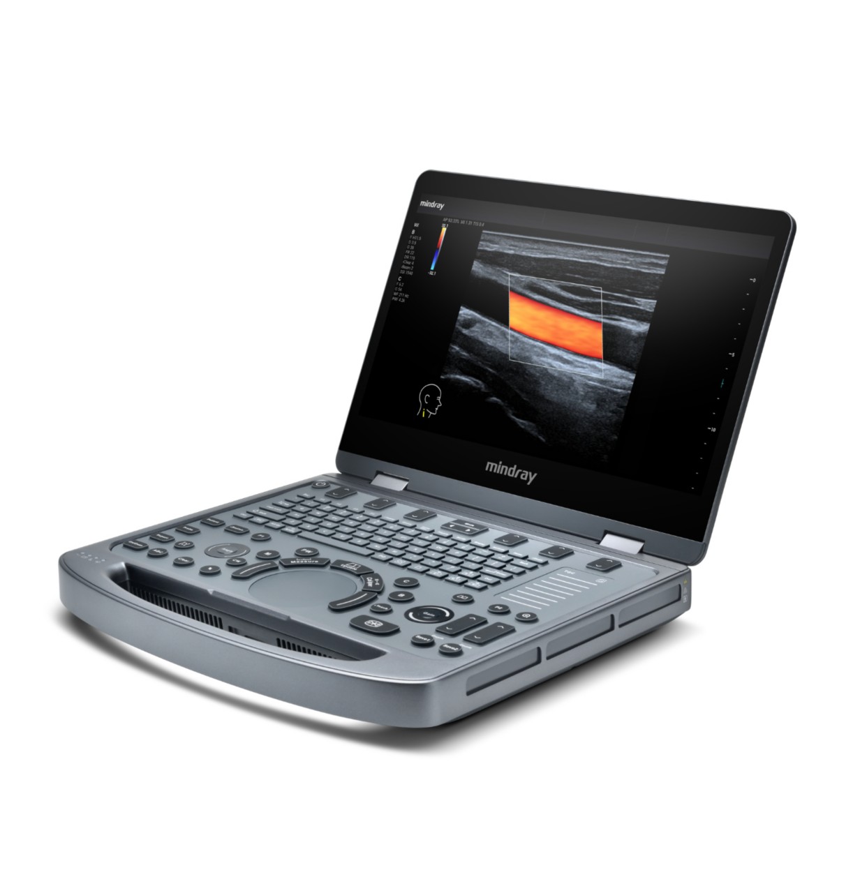 MX6